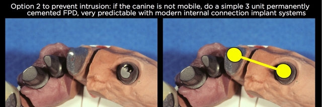 Connecting Teeth and Implants: Yes, No, Maybe? image 7