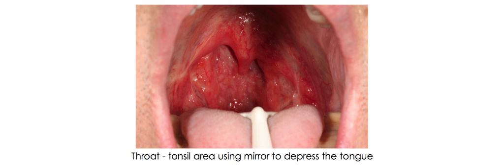 Supplemental Photographs for Airway Screening Winter Supplemental Photos Fig 1