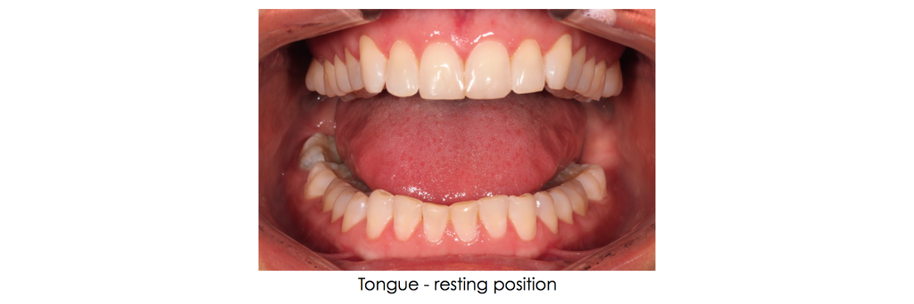 Supplemental Photographs for Airway Screening Winter Supplemental Photos Fig 2