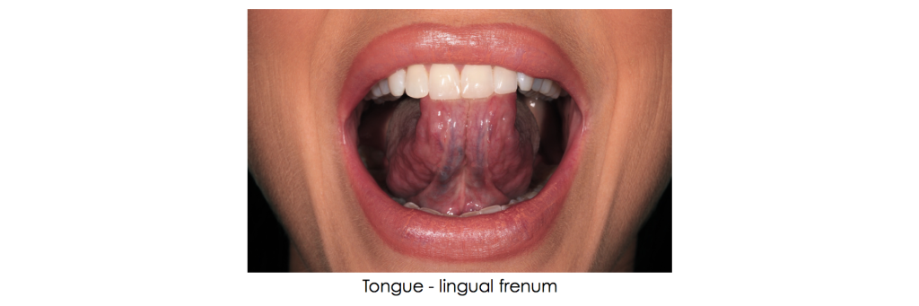 Supplemental Photographs for Airway Screening Winter Supplemental Photos Fig 3