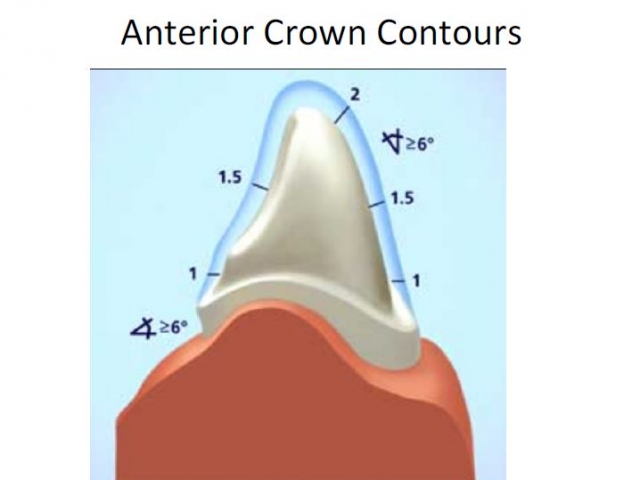 Crown Margin Preparation - Tools of the Trade image 3