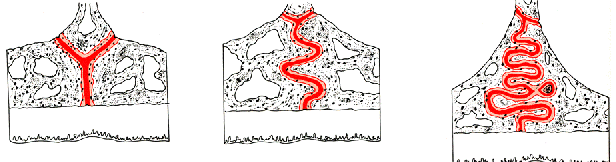 5 Keys for Early Palatal Expansion DonnaStenberg 5KeysEarlyPalatalExpansion Fig.1
