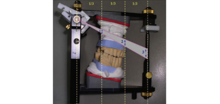 efrver SAM articulator illustrating the Rule of Thirds used to evaluate vertical dimension in dentistry