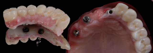 The Biggest Dental Lie 39376