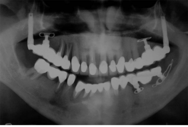 The Biggest Dental Lie image 1