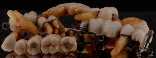 The Biggest Dental Lie image 2