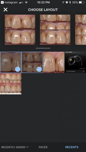 Increase Your Practice’s Social Media Presence by Highlighting Your Everyday Dentistry image 1