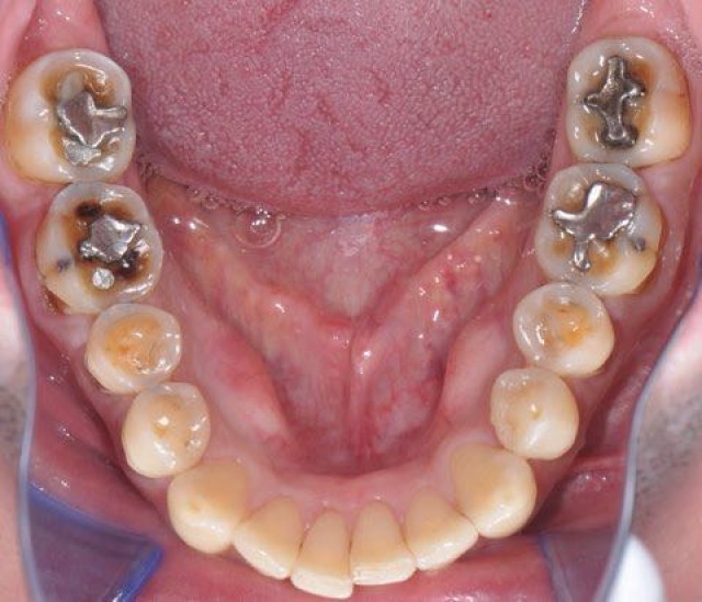 Airway, Sleep and Respiratory Reflux Jeffrey Rouse Airway Sleep and Respiratory Reflux featured image