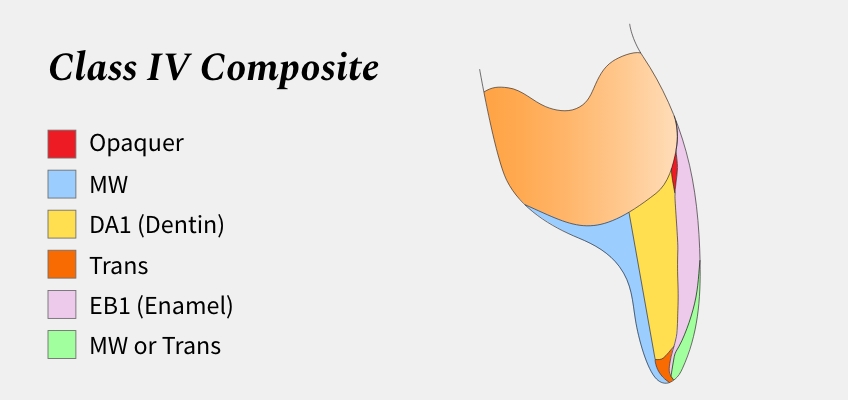 Color and Shade Selection for Anterior Composites image