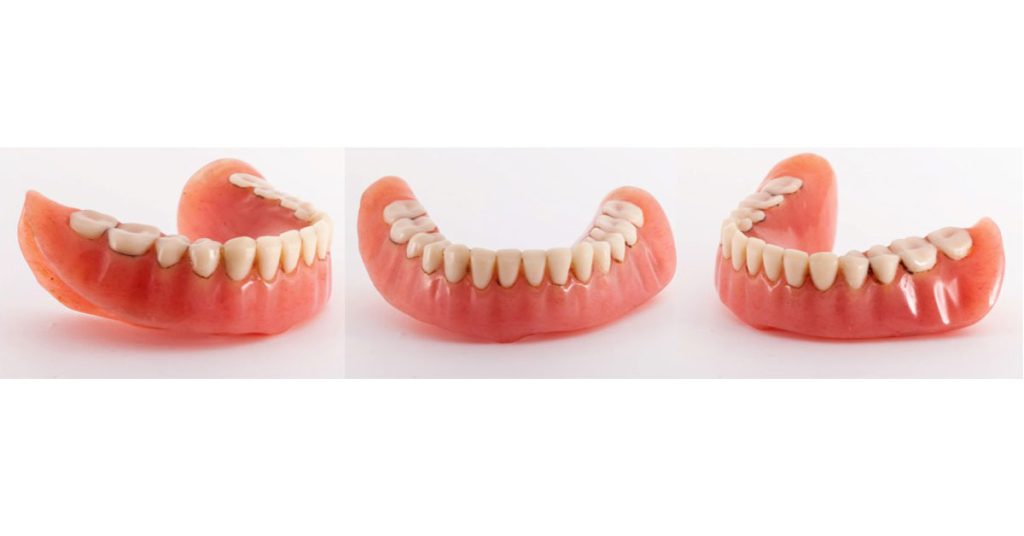Options for Determining Vertical Dimension with Edentulous Patients, Part 2 Darin Dichter VerticalDimensionwithEdentulousPatients 1