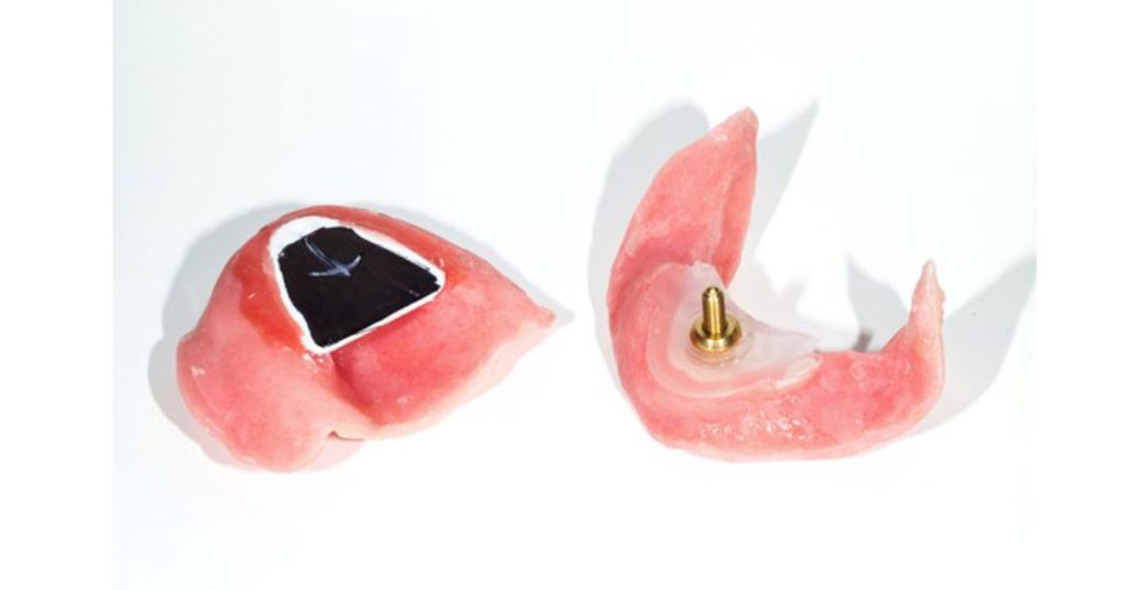 Options for Determining Vertical Dimension with Edentulous Patients, Part 2 Darin Dichter VerticalDimensionwithEdentulousPatients 5