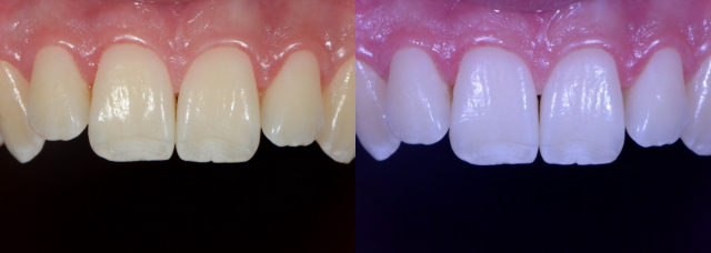 White Balance: The Unsung Hero in Dental Photography DawnWehking white balance featured image