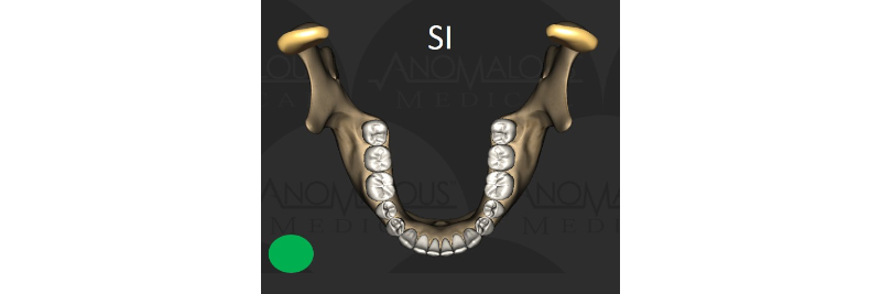 Is TMD Too Minimally Diagnosed? DigestIMG TMDMinimallyDiagnosed IMG2