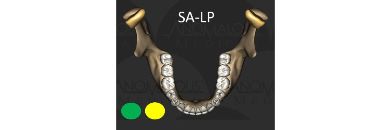 Is TMD Too Minimally Diagnosed? DigestIMG TMDMinimallyDiagnosed IMG3