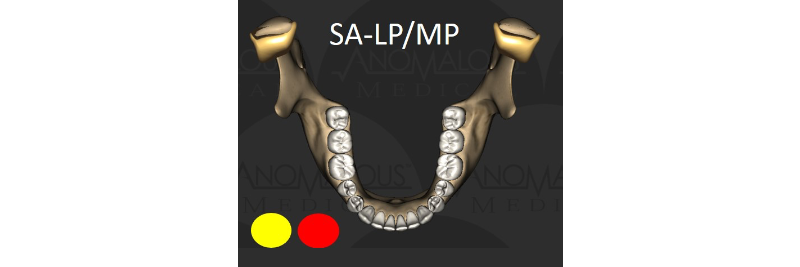 Is TMD Too Minimally Diagnosed? DigestIMG TMDMinimallyDiagnosed IMG4