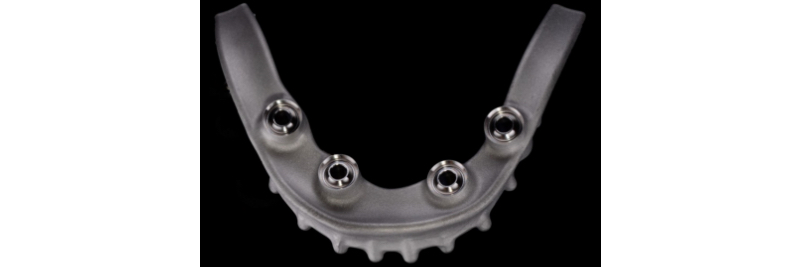 The Use of a Plaster Verification Jig to Ensure Accuracy of the Master Cast Jig Mitrani use plaster verification jig 13