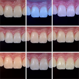 White Balance: The Unsung Hero in Dental Photography Wehking white balance 1