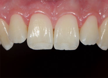 White Balance: The Unsung Hero in Dental Photography Wehking white balance 10