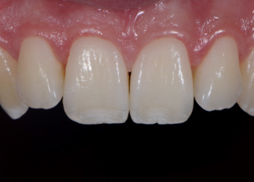 White Balance: The Unsung Hero in Dental Photography Wehking white balance hero 02 1