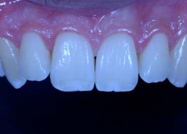 White Balance: The Unsung Hero in Dental Photography Wehking white balance hero 03 1