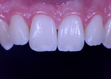 White Balance: The Unsung Hero in Dental Photography Wehking white balance hero 04