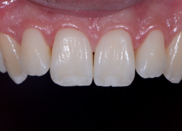 White Balance: The Unsung Hero in Dental Photography Wehking white balance hero 05