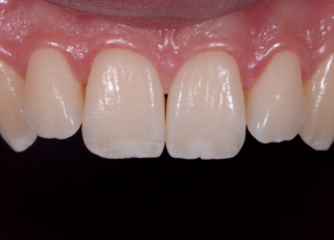 White Balance: The Unsung Hero in Dental Photography Wehking white balance hero 06