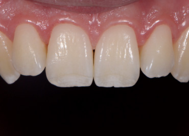 White Balance: The Unsung Hero in Dental Photography Wehking white balance hero 07