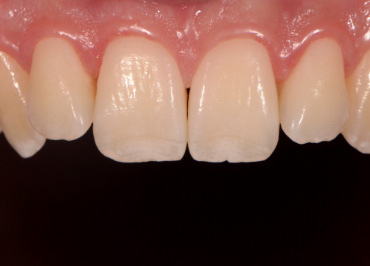 White Balance: The Unsung Hero in Dental Photography Wehking white balance hero 08