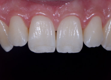 White Balance: The Unsung Hero in Dental Photography Wehking white balance hero 09