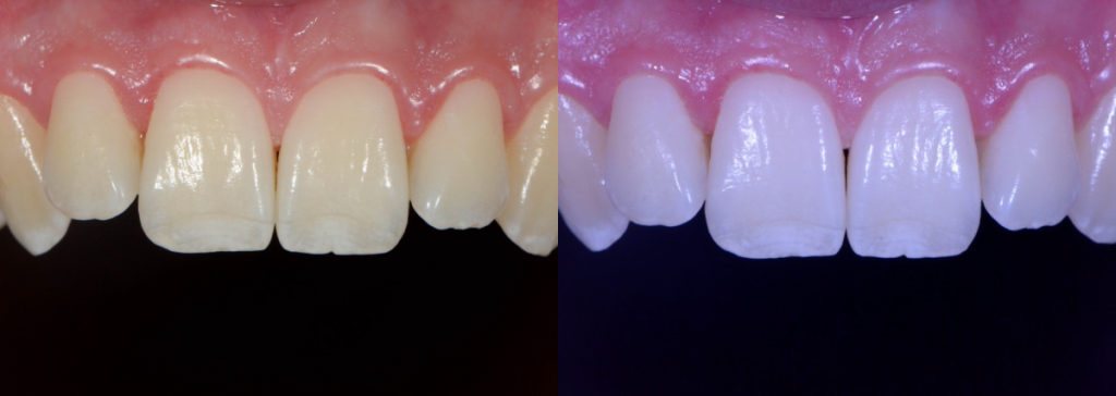 White Balance: The Unsung Hero in Dental Photography Wehking white balance hero