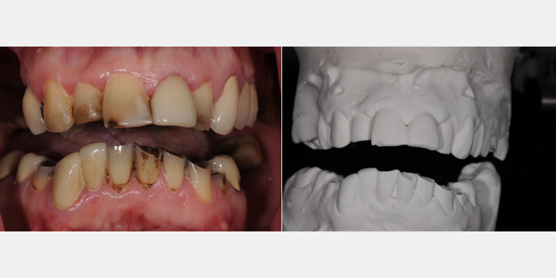 The ‘Trial Smile’ Overlay Template Bonk trial smile overlay 05