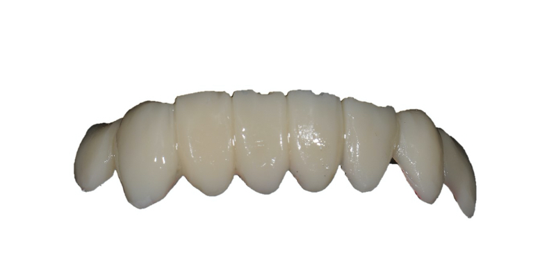 The ‘Trial Smile’ Overlay Template Bonk trial smile overlay 08