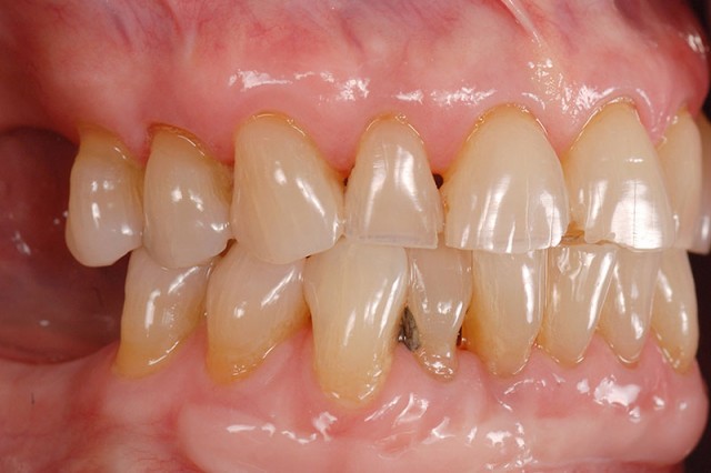 Greggory Kinzer How to Phase Treatment featured image