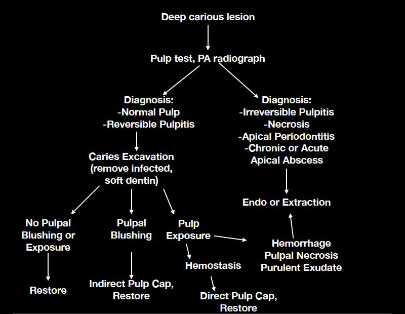 Pulp Capping: Can We and Should We? Janiga pulp capping should we 09