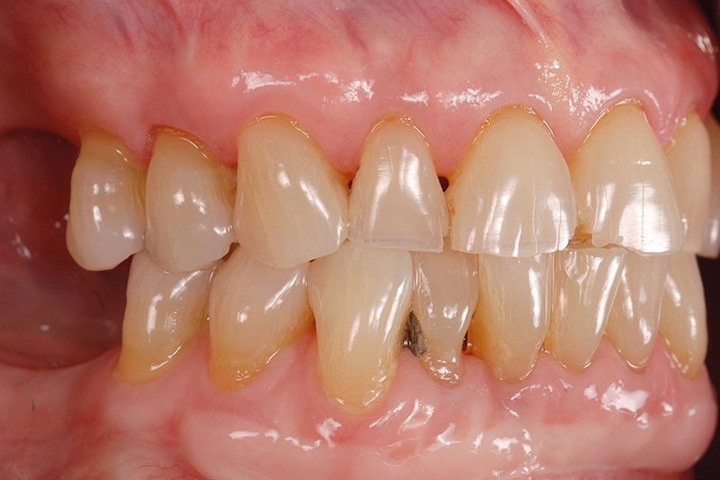 How to Phase Treatment Kinzer how to phase treatment 01 1