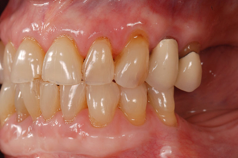 How to Phase Treatment Kinzer how to phase treatment 03 1