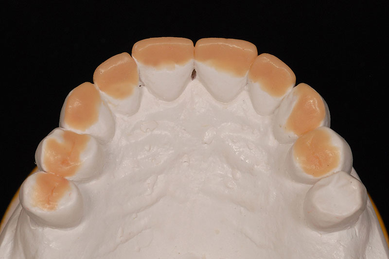 How to Phase Treatment Kinzer how to phase treatment 07