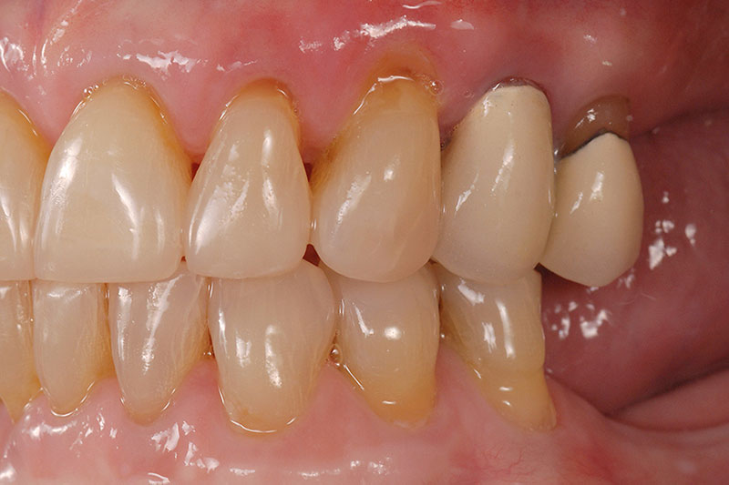 How to Phase Treatment Kinzer how to phase treatment 12