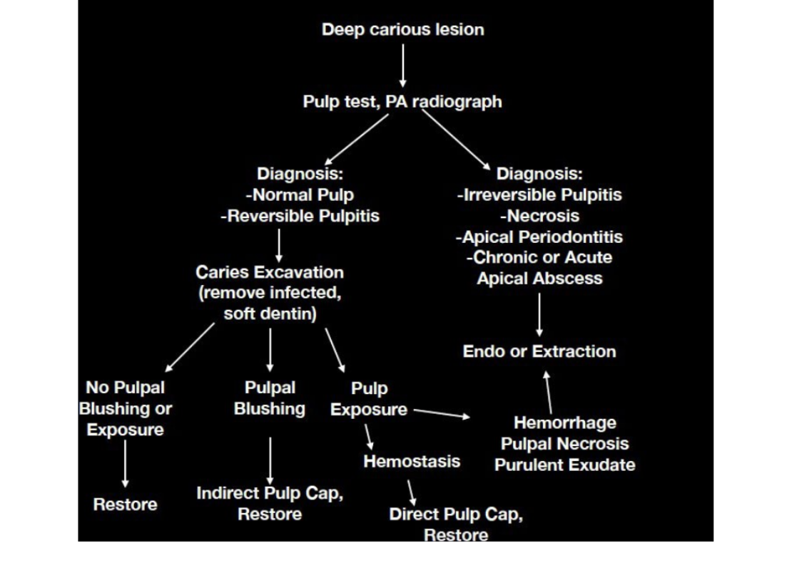 efrver Pulp capping clinical decision-making flowchart showing how diagnosis, caries excavation findings, and pulp status guide treatment with indirect pulp capping, direct pulp capping, restoration, endodontic therapy, or extraction.