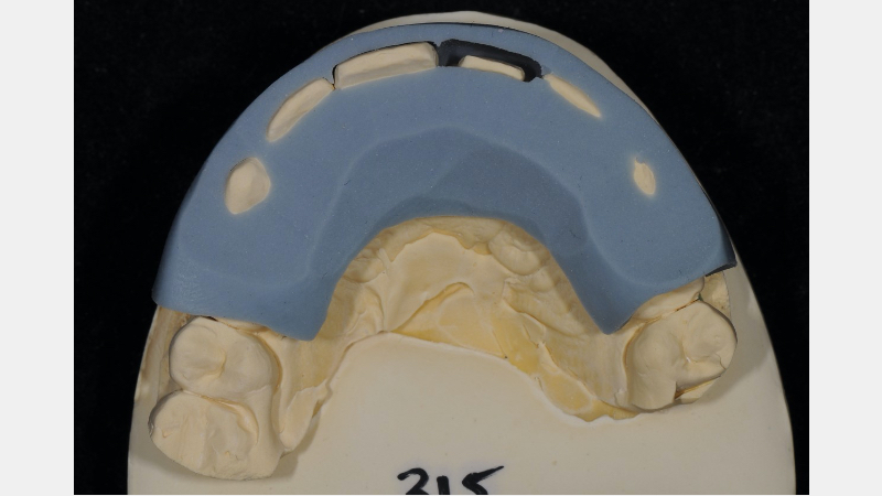 A Guide to Pre-Prep Diagnostic Mock-Ups Bonk guide pre prep diagnostic mock ups 12 1