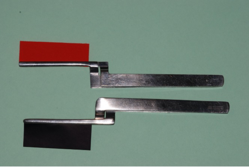 Some Questions I’ve Been Asked About Occlusion Over the Years Steinberg some questions ive been asked 03