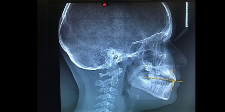 CBCT: A Window Into ‘Why’