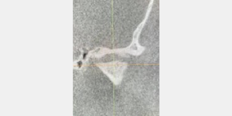 CBCT: A Window Into ‘Why’ Cohen cbc2 window into why 03