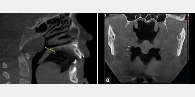 CBCT: A Window Into ‘Why’ Cohen cbc2 window into why 05
