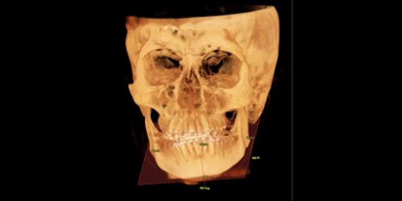 CBCT: A Window Into ‘Why’ Cohen cbc2 window into why 06