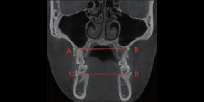 CBCT: A Window Into ‘Why’ Cohen cbc2 window into why 07