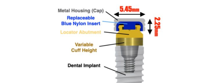 Where Is the Line With Locators?