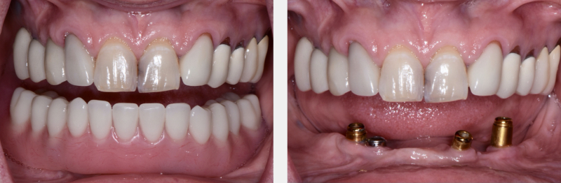 Where Is the Line With Locators? Benting where is line locators 02