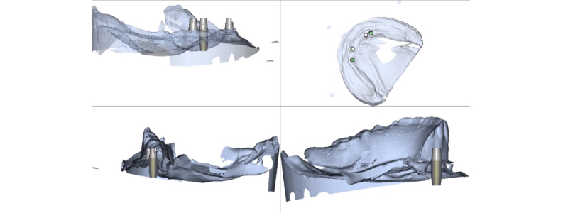 Where Is the Line With Locators? Benting where is line locators 04